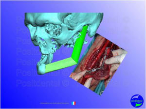 Mise en chage imm diate 041 ffmu02 - Eugenol