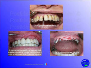 Mise en chage imm diate 047 fmcmp8 - Eugenol