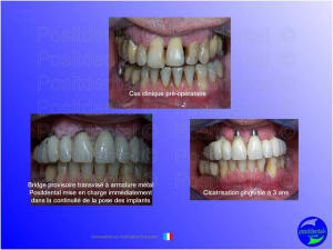 Mise en chage imm diate 049 jmtg2o - Eugenol