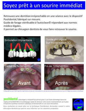 Mise en chage imm diate 061 hpqio7 - Eugenol