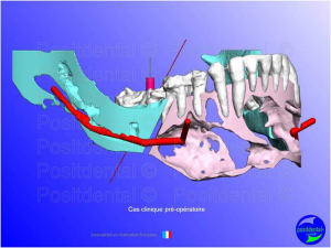 Mise en chage imm diate 065 v0zjqv - Eugenol