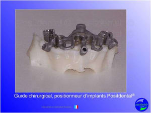 Mise en chage imm diate 108 mdxeyl - Eugenol
