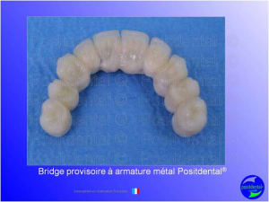 Mise en chage imm diate 113 pgi1fw - Eugenol