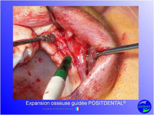 Mise en chage imm diate 131 jknjb9 - Eugenol