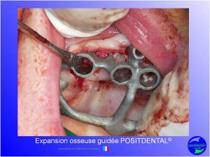 Mise en chage imm diate 137 xnd3m7 - Eugenol