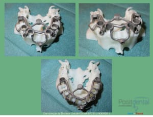 Mise en charge immédiade c - Eugenol