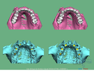 Mise en charge immédiade c - Eugenol