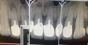 Non endo 4 2019 09 03 19.24 - Eugenol
