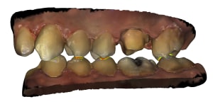 Occlusion 1 id62 ikwbnl - Eugenol