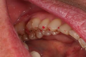 Oim bas gauche d4ewj0 - Eugenol