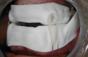 Orm  lastiques id7cua - Eugenol