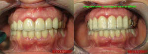 Occlusodontologie 01bis ieps9h - Eugenol