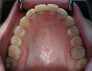 P1010005 m33yjc - Eugenol