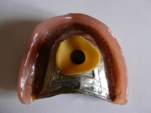 P1050835 l5k7ek - Eugenol