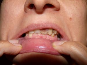 P1070084 od3jc6 - Eugenol