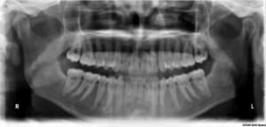 P3 vhlgmf - Eugenol