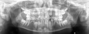 Pano fcgqwq - Eugenol