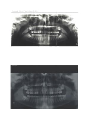 Pano ykwafg - Eugenol