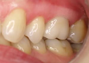 Pb296411   copie gnh1ys - Eugenol