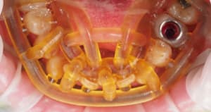 Pc080347 wmlwth - Eugenol