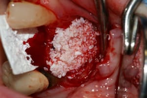 Pict1452biooss v4bvgo - Eugenol