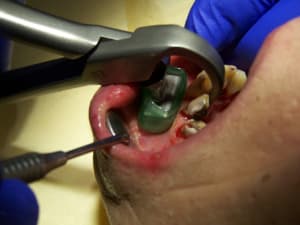 Positdental 141120 101 jkn194 - Eugenol