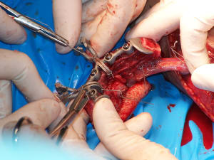 Positdental 141229 138 ksucyt - Eugenol