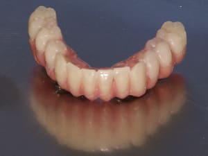 Positdental 14 08 19 060 shw2dz - Eugenol