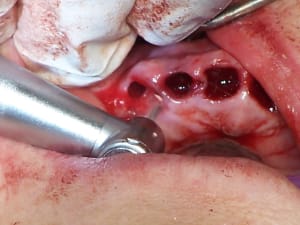 Positdental 150626 194 cjxkkj - Eugenol