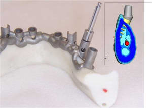 Positdental 4 rhhd8i - Eugenol