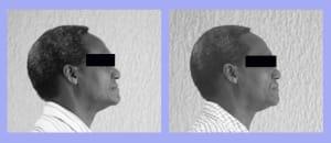 Profil 1 dvunna - Eugenol