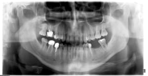 Pano 22032014 h3st92 - Eugenol