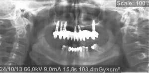 Pano 5 mck7il - Eugenol
