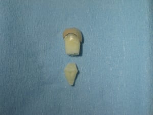 Photo34 003 pbvnbw - Eugenol