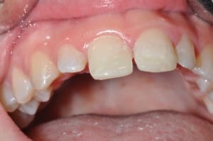 Photo 014 qnxney - Eugenol