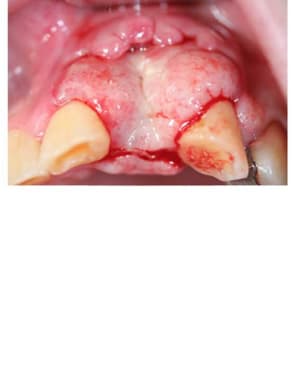 Planche contact 003 copie tnlvzw - Eugenol