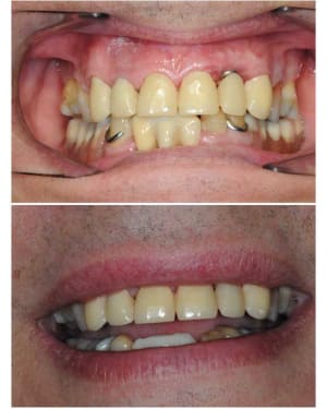 Planche contact 015 copie iugzet - Eugenol