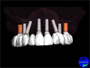 Positdental 003 dbgg3j - Eugenol