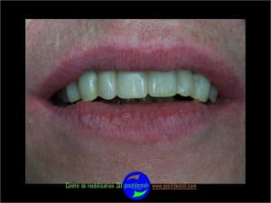 Positdental planification 3d 4 avl8uu - Eugenol