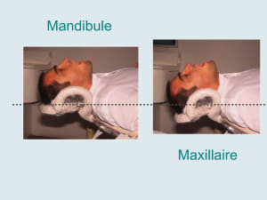 Positions de la t te igsc0b - Eugenol