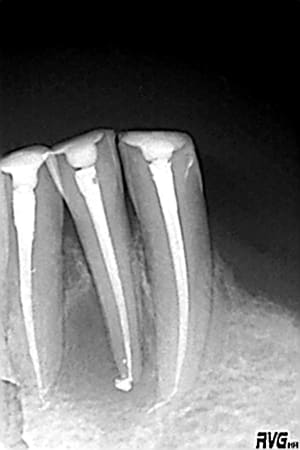 R16 tstz9o - Eugenol