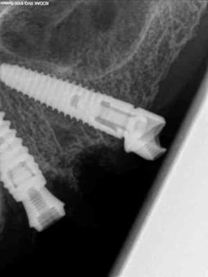 R17 kniyhv - Eugenol