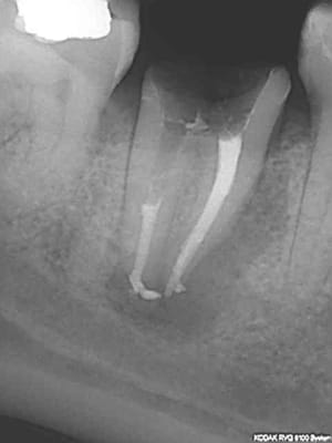 R27 n3n02l - Eugenol