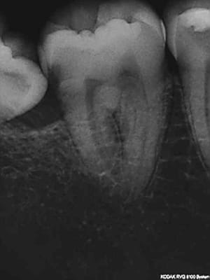 R2 dumhjt - Eugenol