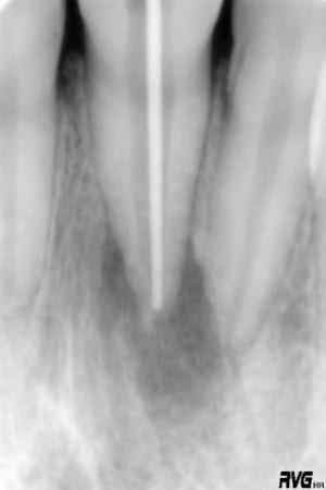 R4 ki1cxh - Eugenol