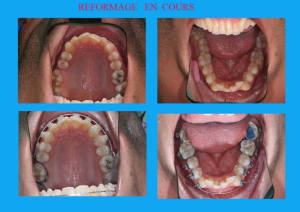 Reformage en cours 1 ssjpzu - Eugenol