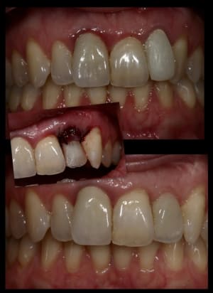 Renoult wxhhvs - Eugenol