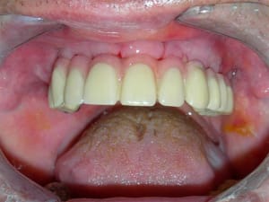 Rscn1876 w5uy6e - Eugenol