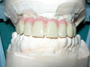 Rscn1879 mfncjg - Eugenol