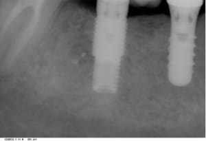R foisy j 20150622 1749 ksaf0u - Eugenol